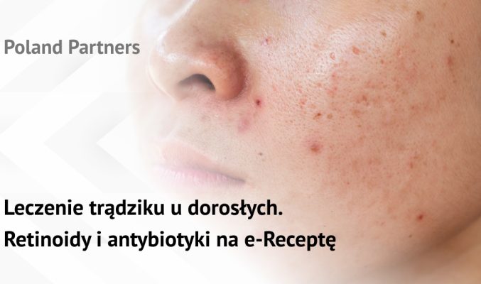 Leczenie trądziku u dorosłych. Retinoidy i antybiotyki na e-Receptę