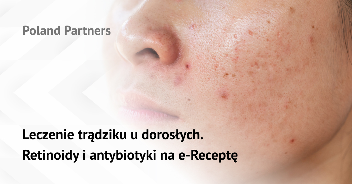 Leczenie trądziku u dorosłych. Retinoidy i antybiotyki na e-Receptę